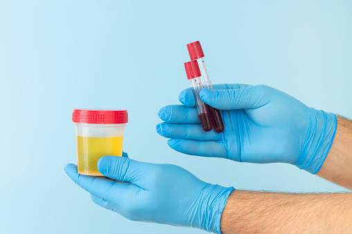 Usage Tips and Tricks for Synthetic Urine Kits: Ensuring Effectiveness and Discretion