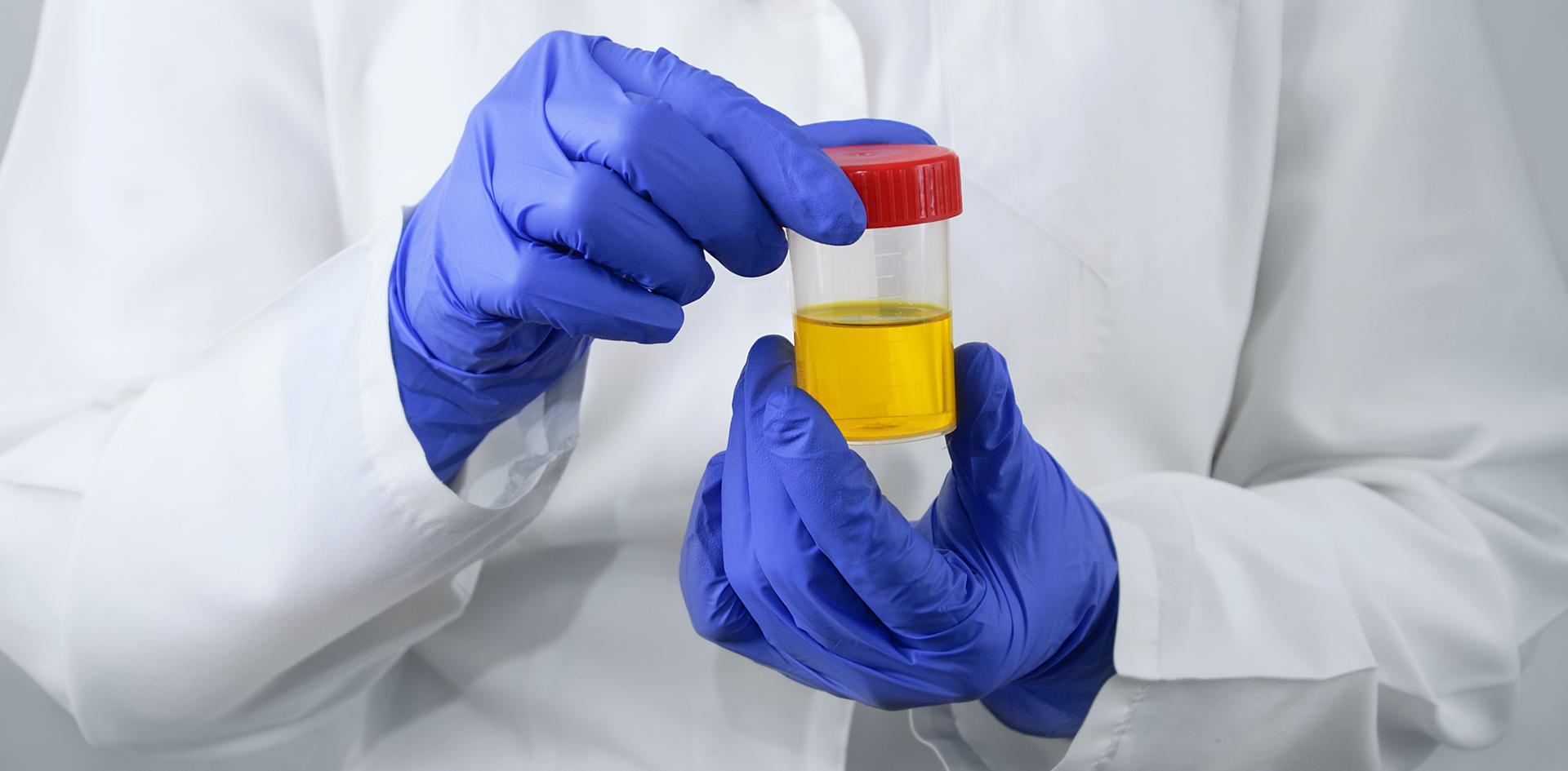 How Long Can You Store Quick Fix Synthetic Urine?